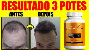 folixil